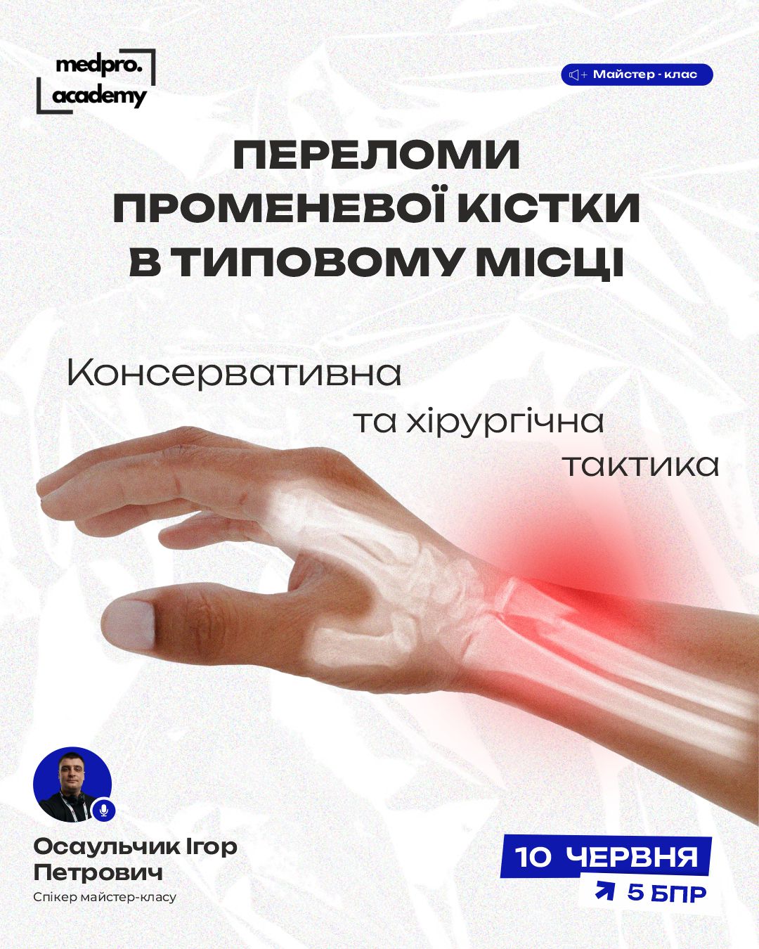 3Сучасний алгоритм вибору консервативної та хірургічної тактики при переломах променевої кістки в типовому місці